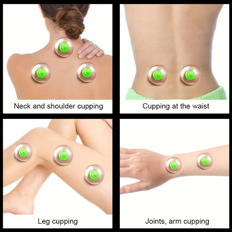 VACUUM CUPPING THERAPY SET - SimplyLife